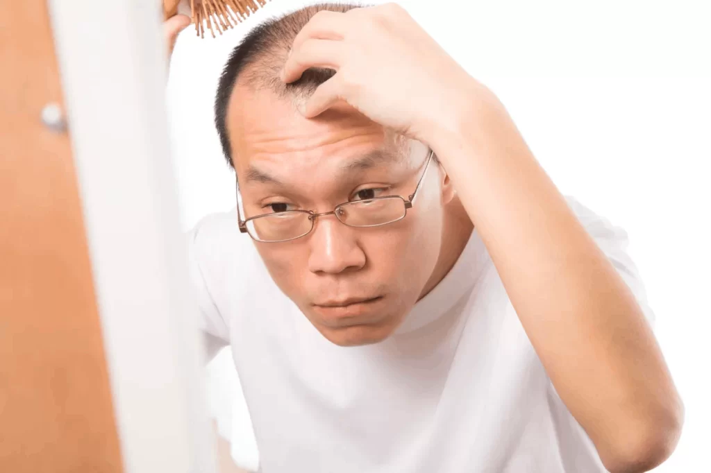 抜け毛が気になる男