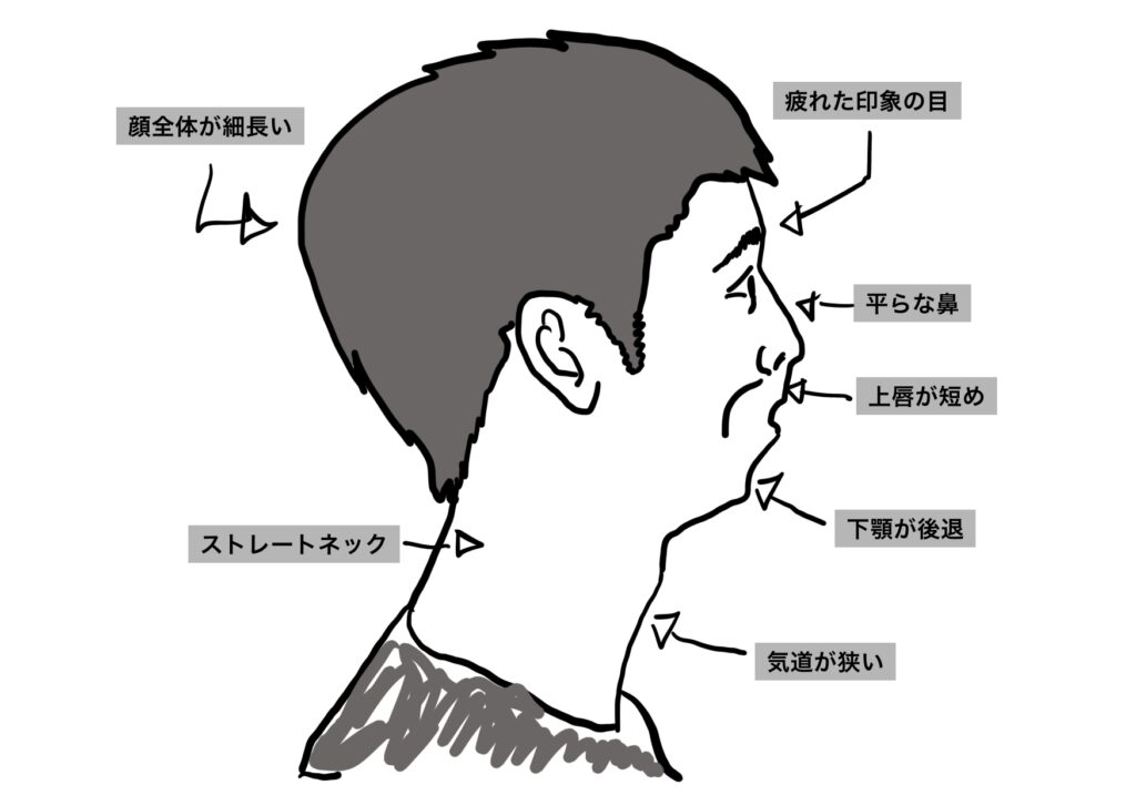 口呼吸の人の特徴
