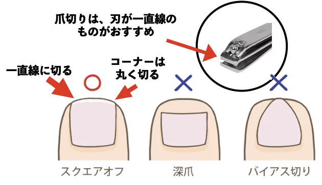 爪切りの基本